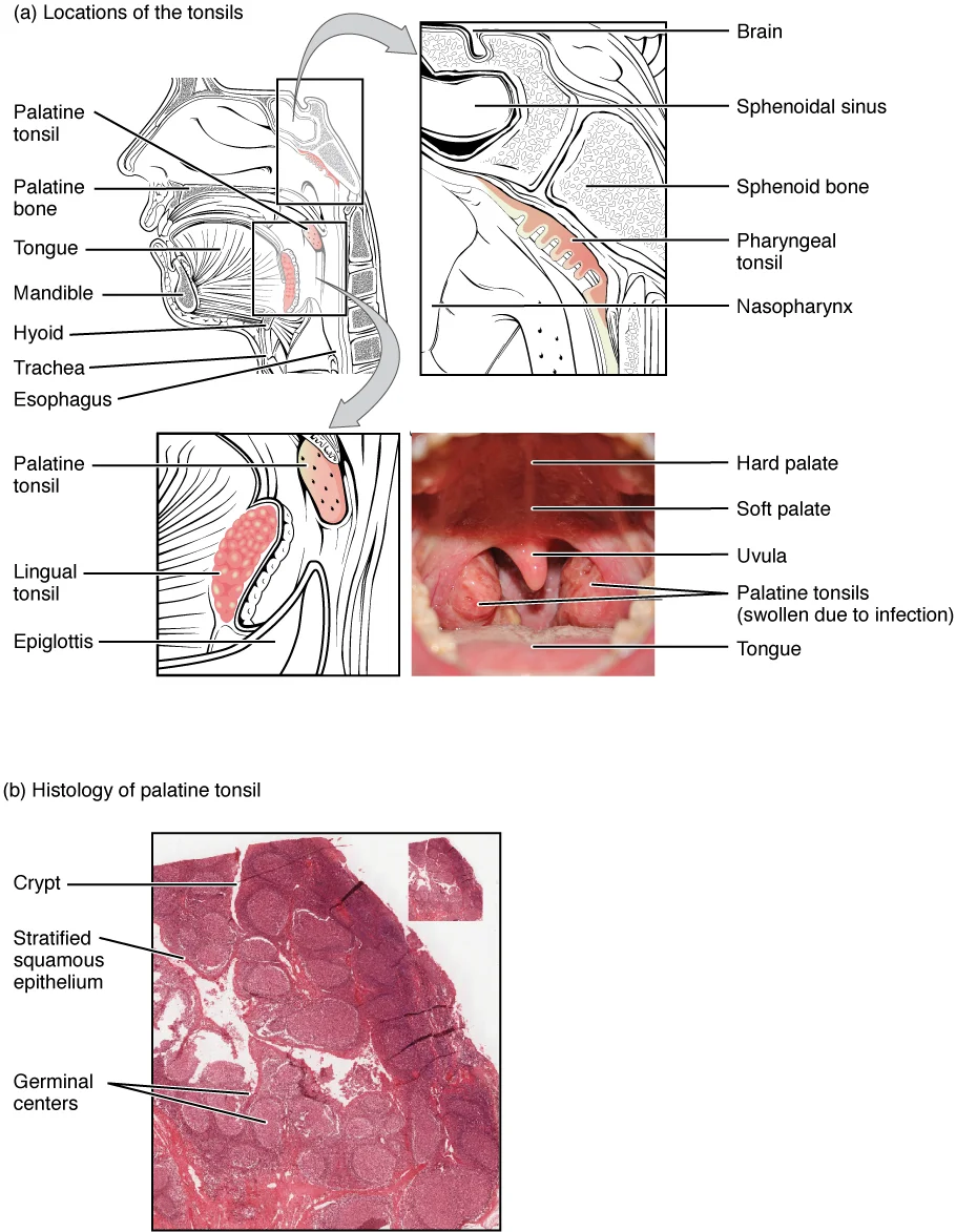 Hipersensitivitas & Anafilaksis
