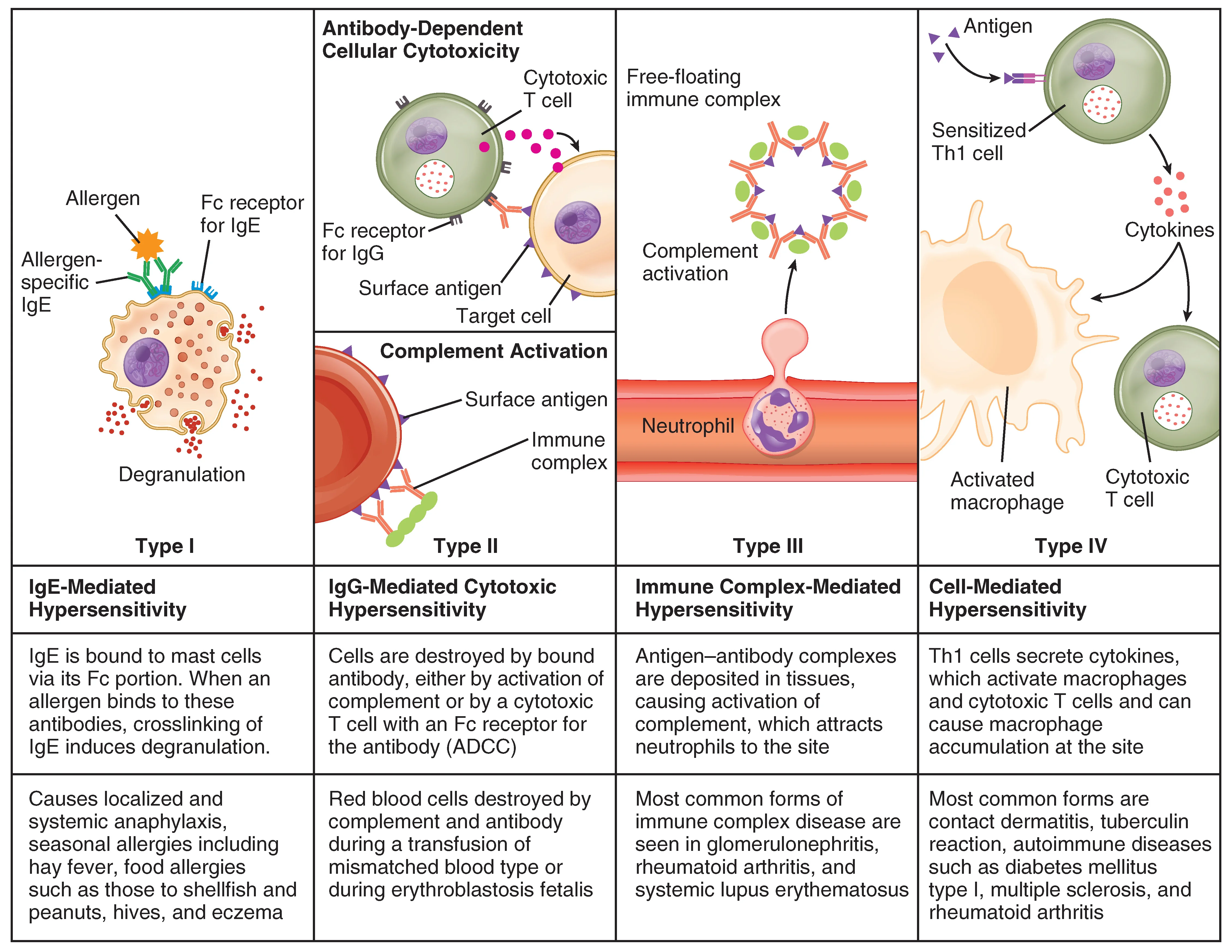 Hipersensitivitas Tipe II, III, dan IV