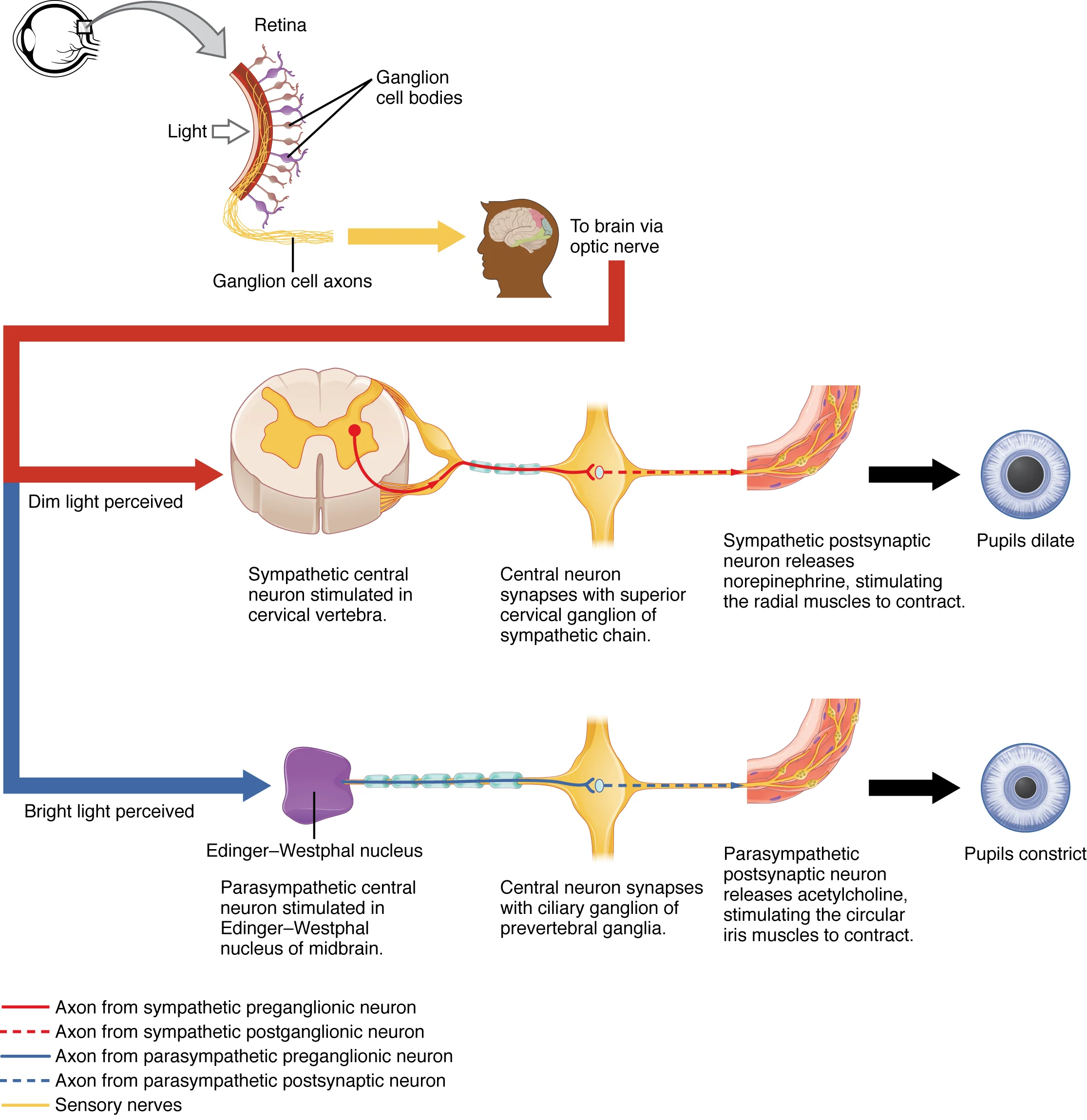 Vestibular — BPPV & Manuver Epley