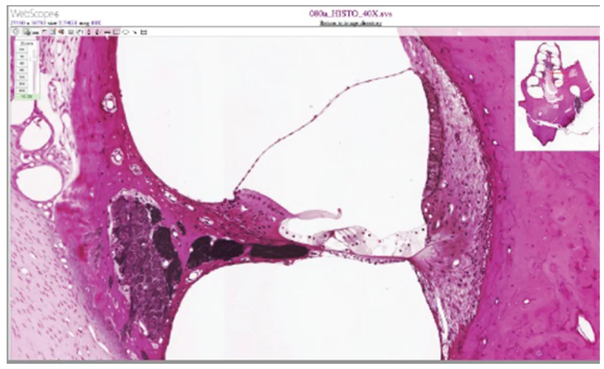 Retina dan Fotoreseptor
