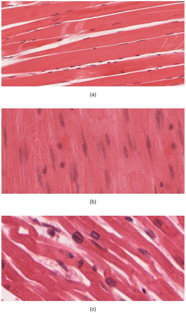 Dermis