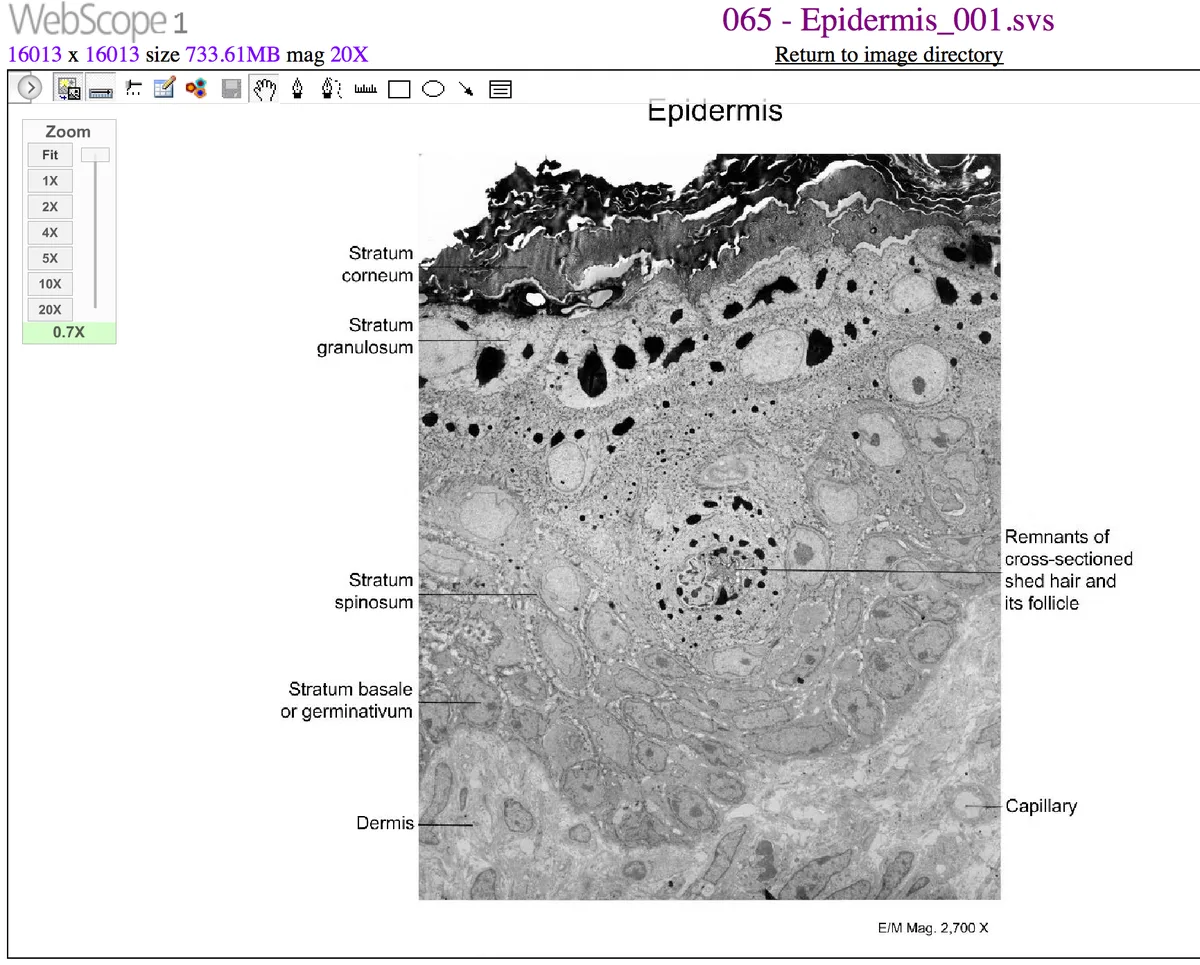 Epidermis