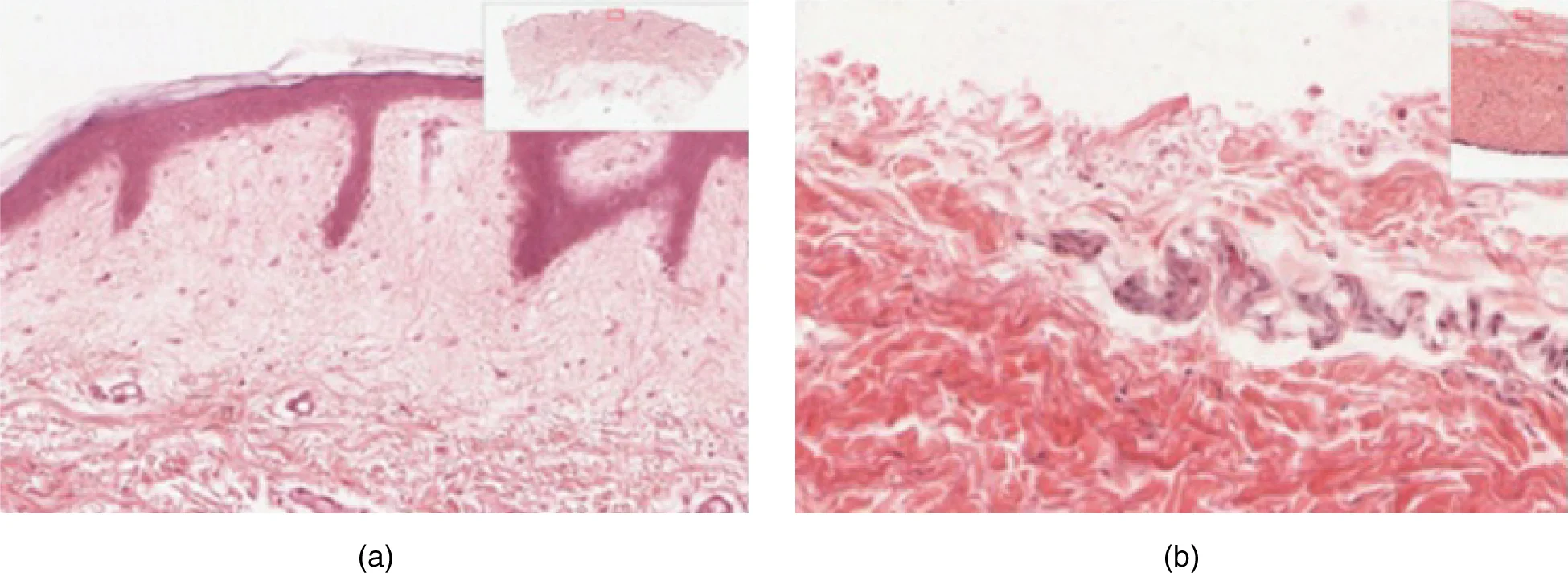 Epidermis — Lapisan & Melanosit