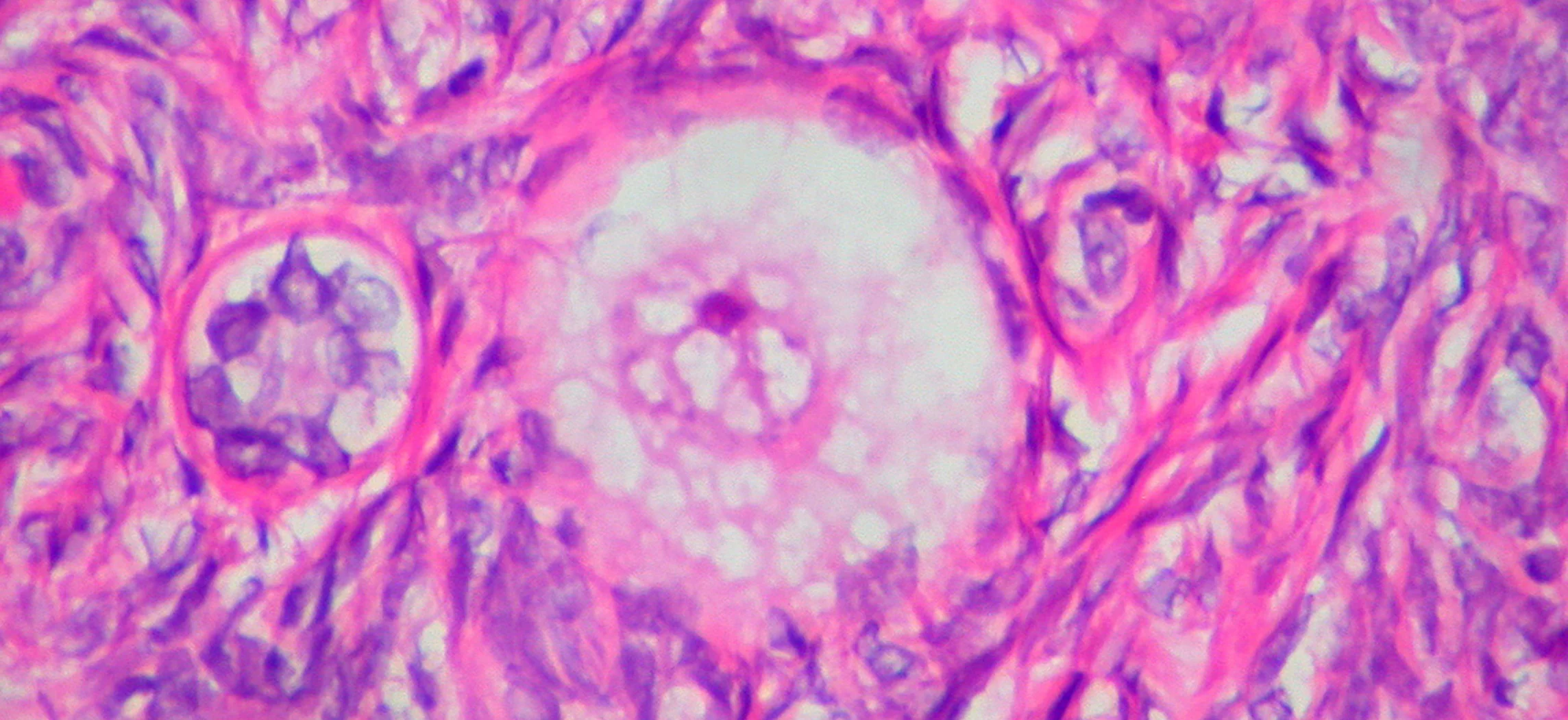 Ovulasi & Siklus Ovarium