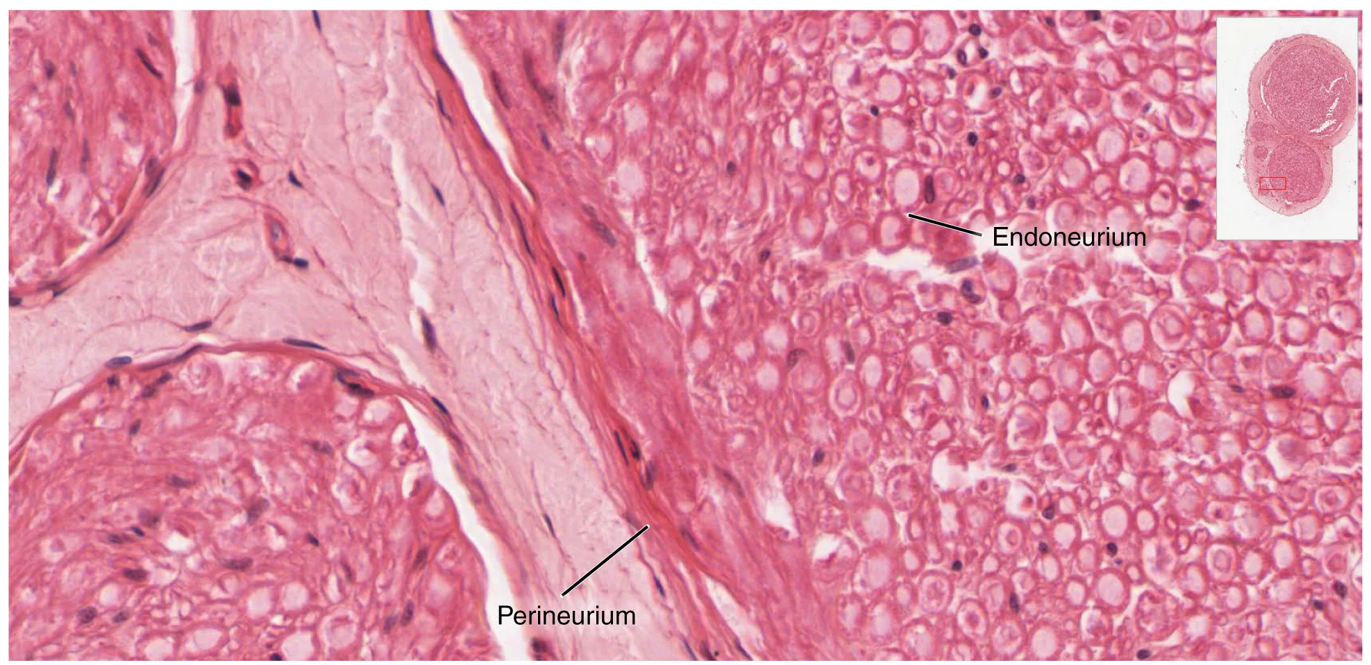 Histologi Saraf & Diagnostik NCS/EMG
